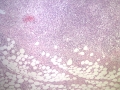 Atypical CML (H&E, dog, lymph node)