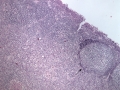 Atypical CML (H&E, dog, tonsil)