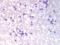 CLL blood (horse)