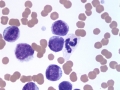 CLL blood (horse)