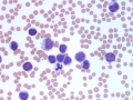 CLL blood (horse)