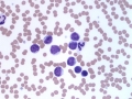 CLL blood (horse)