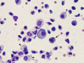 Chylous effusion (cat, Wright's)