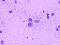 Chylous effusion (cat, new methylene blue, NMB)