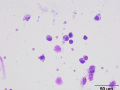 Lymphoma of granular lymphocytes (cat)