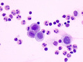 Mast cell tumor (cat)