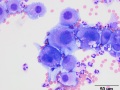 Neoplastic effusion (dog)