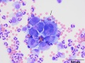 Neoplastic effusion (dog)