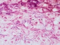 Pyothorax (cat)