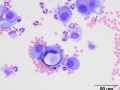 Neoplastic effusion (dog)