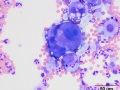 Neoplastic effusion (dog)