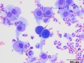 Neoplastic effusion (dog)