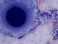 Mesothelioma (dog)