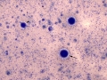 Mesothelioma (dog)