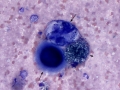 Mesothelioma (dog)