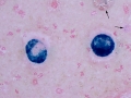 Mesothelioma (dog)