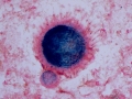 Mesothelioma (dog)