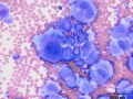Neoplastic effusion (dog)