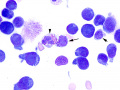 Lymphoma (dog)