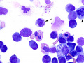 Lymphoma (dog)
