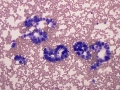 Mesothelial cells