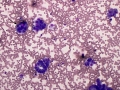 Mesothelial cells