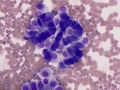 Mesothelial cells