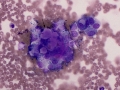 Mesothelial cells