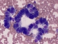 Mesothelial cells