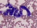 Mesothelial cells
