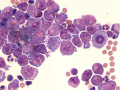 Mast cell tumor (dog)