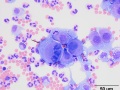 Neoplastic effusion (dog)