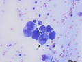 Mitotic figure
