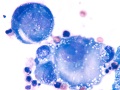 Carcinoma (dog)