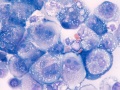 Carcinoma (dog)