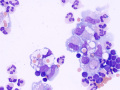 Chylous effusion (cat)