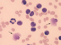 Chylous effusion (dog)