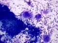 Megakaryocytic dysplasia (cat)