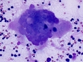 Megakaryocytic dysplasia (cat)