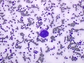 FIV dysplasia
