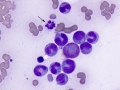 FIV dysplasia