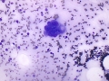 FIV dysplasia