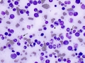 FIV dysplasia