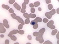 Dysplastic RBC (horse)