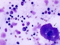 Megakaryocytic dysplasia (cat)