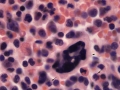 Dysplasia (cat, H&E)