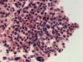 Dysplasia (cat, H&E)