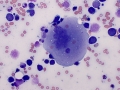 Megakaryocyte dysplasia (dog)