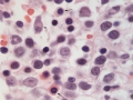MDS (cat, H&E)