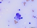Dysplastic megakaryocyte (cat)